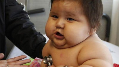El sobrepeso y la obesidad infantil, una preocupación internacional