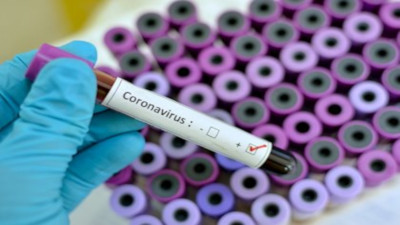 Suman 229 los muertos por Coronavirus en Argentina
