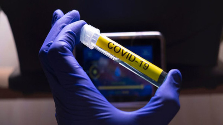 Nación estima que alguna de las vacunas contra el Covid estará “antes de fin de año”