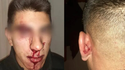 Brutal agresión a policías en Cholila