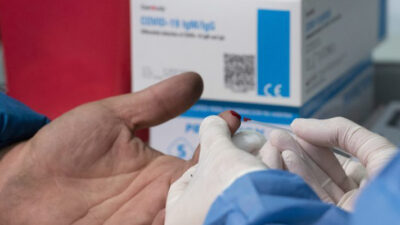 CONICET, coronavirus, covid, FlashPrep, test rápido, UBA, virus