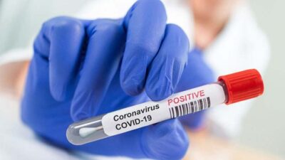 Coronavirus Chubut: el 55% de internados en camas críticas son menores de 60 años