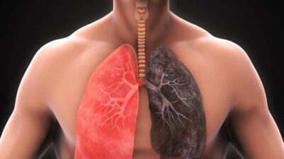 coronavirus, covid-19, enfermedades respiratorias, epoc, pandemia, salud