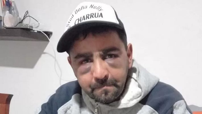 Puerto Deseado: denuncian a policías por golpear y torturar a un detenido