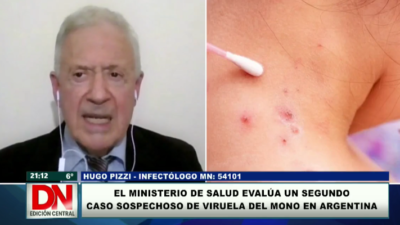 cuarentena, viruela, viruela del mono, viruela símica