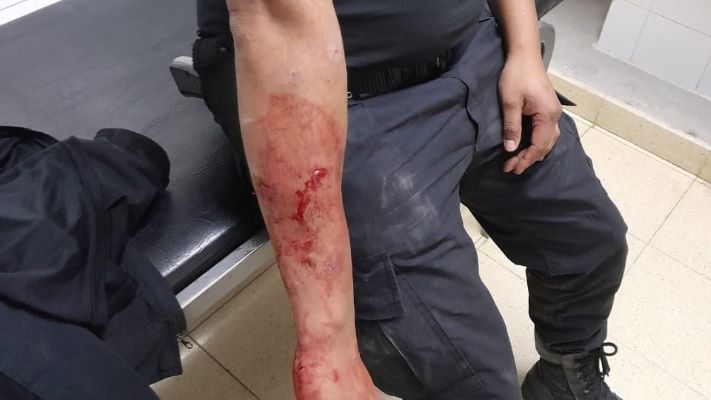 Madryn: policía fue a controlar a un detenido y lo atacó un Pitbull