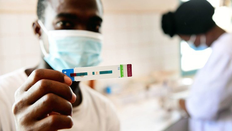 Alerta por el aumento de los casos de VIH en 28 países