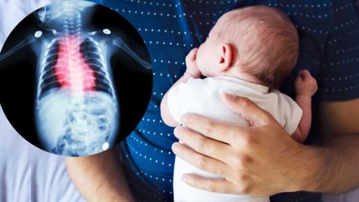 Realizaran actividades de concientización por el Día de las Cardiopatías Congénitas
