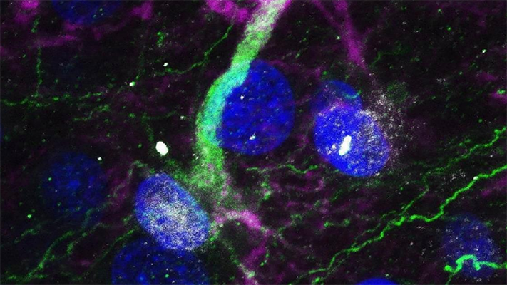 Etiquetas: CIENCIA, noticias, parkinson, salud