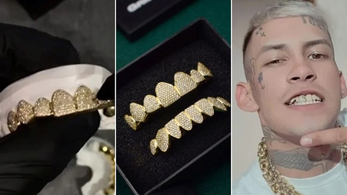 L-Gante mostró su nueva dentadura postiza con detalles de oro e incrustaciones de diamante