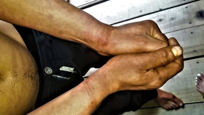 Detuvieron a dos policías por torturar a un joven: “Si denunciás te matamos”