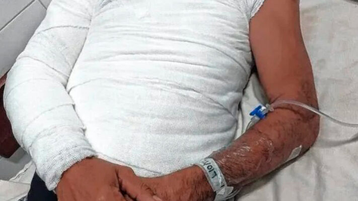 cuerpo quemado, HERMANOS, k sachet de mayonesa, PELEA, Santa Fe