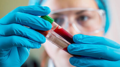 Un nuevo tratamiento para la hemofilia está disponible en Argentina