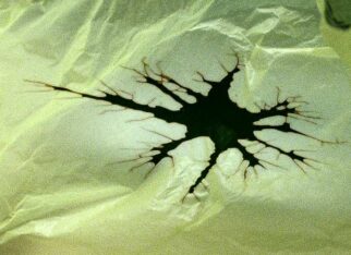 Hallan relaciones directas entre ictus y demencia con partículas de plástico en el cerebro