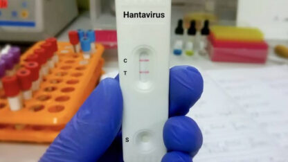El desfinanciamiento en ciencia impide la creación de kits de detección de hantavirus