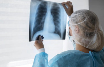 Alerta por el aumento de casos de tuberculosis en Argentina